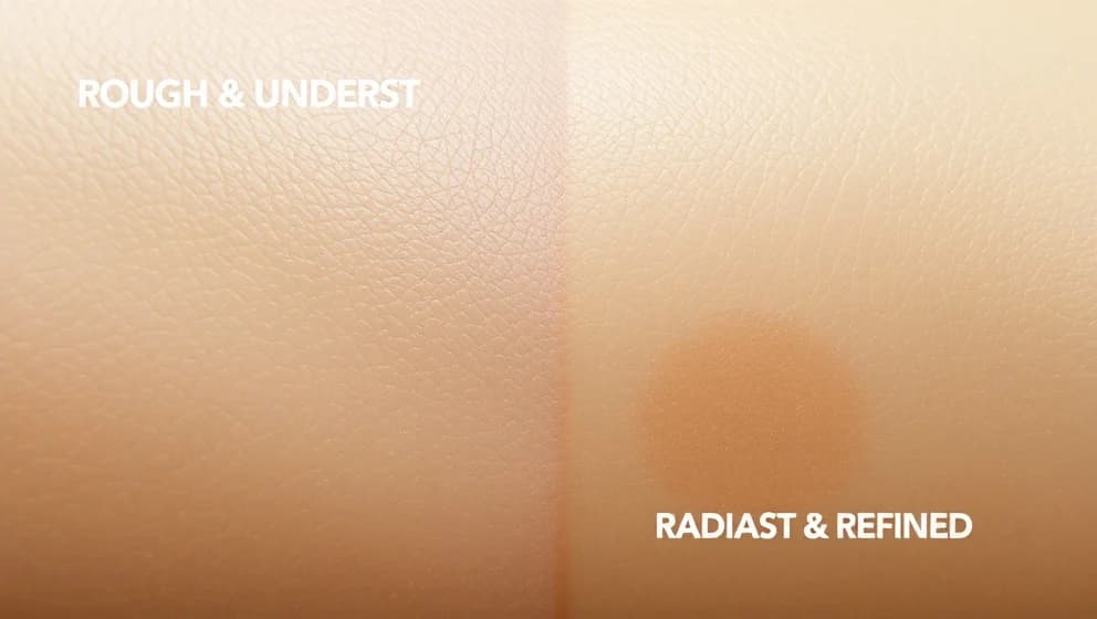 CO2 laser före efter resultat